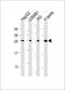 C-type lectin domain family 1 member B antibody, M06619, Boster Biological Technology, Western Blot image 
