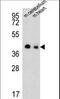 TPC antibody, LS-B9893, Lifespan Biosciences, Western Blot image 