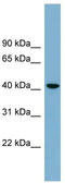 Beta-1,4-Galactosyltransferase 2 antibody, TA336172, Origene, Western Blot image 