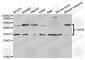 VAMP Associated Protein B And C antibody, A5363, ABclonal Technology, Western Blot image 