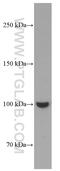 Myelin Associated Glycoprotein antibody, 66709-1-Ig, Proteintech Group, Western Blot image 
