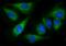 Glutamyl-Prolyl-TRNA Synthetase antibody, M02967, Boster Biological Technology, Immunofluorescence image 