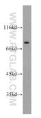 Nucleoporin 88 antibody, 55465-1-AP, Proteintech Group, Western Blot image 