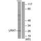 Lecithin retinol acyltransferase antibody, A03362, Boster Biological Technology, Western Blot image 