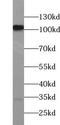 Ubiquitin Specific Peptidase 10 antibody, FNab09304, FineTest, Western Blot image 