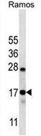 Chromosome 15 Open Reading Frame 40 antibody, AP50996PU-N, Origene, Western Blot image 