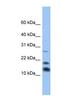 Nuclear nucleic acid-binding protein C1D antibody, NBP1-79373, Novus Biologicals, Western Blot image 