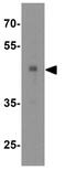 N-Acylsphingosine Amidohydrolase 1 antibody, GTX31356, GeneTex, Western Blot image 