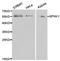 Sphingosine kinase 1 antibody, TA326762, Origene, Western Blot image 