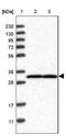 Ubiquitin Protein Ligase E3D antibody, NBP1-86757, Novus Biologicals, Western Blot image 