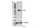 Tryptophan Hydroxylase 1 antibody, 12339S, Cell Signaling Technology, Western Blot image 
