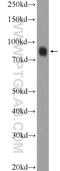 Zinc Finger Protein 184 antibody, 26100-1-AP, Proteintech Group, Western Blot image 