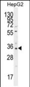 Olfactory Receptor Family 52 Subfamily I Member 2 antibody, PA5-71590, Invitrogen Antibodies, Western Blot image 