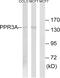Protein Phosphatase 1 Regulatory Subunit 3A antibody, GTX87725, GeneTex, Western Blot image 