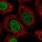 Zinc finger protein 704 antibody, NBP1-93998, Novus Biologicals, Immunocytochemistry image 