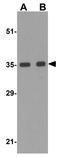 BRCA1/BRCA2-Containing Complex Subunit 3 antibody, GTX31765, GeneTex, Western Blot image 