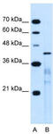MARVEL Domain Containing 3 antibody, TA336071, Origene, Western Blot image 