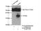 Gamma-Glutamyl Hydrolase antibody, 13264-1-AP, Proteintech Group, Immunoprecipitation image 