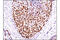 Progesterone Receptor antibody, 8757T, Cell Signaling Technology, Immunohistochemistry paraffin image 