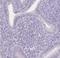 Uroplakin 2 antibody, NBP2-38904, Novus Biologicals, Immunohistochemistry frozen image 