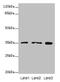 Fumarylacetoacetate Hydrolase Domain Containing 2A antibody, CSB-PA822218LA01HU, Cusabio, Western Blot image 