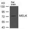Maternal Embryonic Leucine Zipper Kinase antibody, PA5-49684, Invitrogen Antibodies, Western Blot image 