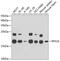Ribosomal Protein S10 antibody, 19-990, ProSci, Western Blot image 