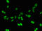 Metallothionein 1E antibody, LS-C285772, Lifespan Biosciences, Immunofluorescence image 