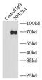 Nuclear factor erythroid 2-related factor 1 antibody, FNab05693, FineTest, Immunoprecipitation image 