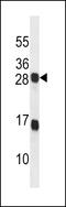 KDEL Endoplasmic Reticulum Protein Retention Receptor 2 antibody, 57-940, ProSci, Western Blot image 