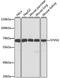E3 ubiquitin-protein ligase synoviolin antibody, MBS126640, MyBioSource, Western Blot image 