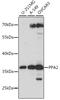 Pyrophosphatase (Inorganic) 2 antibody, A15819, ABclonal Technology, Western Blot image 
