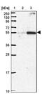 Family With Sequence Similarity 222 Member B antibody, NBP2-14388, Novus Biologicals, Western Blot image 