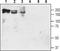 Solute carrier family 12 member 2 antibody, TA328693, Origene, Western Blot image 