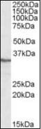Protein Phosphatase 4 Catalytic Subunit antibody, orb89000, Biorbyt, Western Blot image 