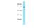 Coiled-Coil Domain Containing 155 antibody, PA5-46337, Invitrogen Antibodies, Western Blot image 