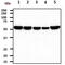 Pyruvate Kinase L/R antibody, GTX57581, GeneTex, Western Blot image 