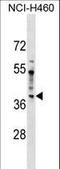 Serologically Defined Colon Cancer Antigen 8 antibody, LS-C158931, Lifespan Biosciences, Western Blot image 