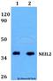 Nei Like DNA Glycosylase 2 antibody, A04883, Boster Biological Technology, Western Blot image 