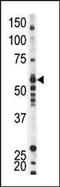 Proto-oncogene tyrosine-protein kinase Yes antibody, PA5-14800, Invitrogen Antibodies, Western Blot image 
