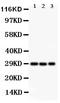 Potassium Voltage-Gated Channel Interacting Protein 3 antibody, PA2272, Boster Biological Technology, Western Blot image 