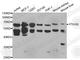 Parathyroid Hormone 1 Receptor antibody, A1744, ABclonal Technology, Western Blot image 