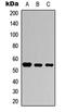 SMAD Family Member 3 antibody, LS-C358328, Lifespan Biosciences, Western Blot image 