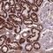 Nudix Hydrolase 16 Like 1 antibody, NBP2-49400, Novus Biologicals, Immunohistochemistry frozen image 