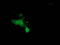 E3 ubiquitin-protein ligase MGRN1 antibody, TA502684, Origene, Immunofluorescence image 