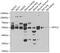 Spt1 antibody, GTX32895, GeneTex, Western Blot image 