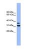 Olfactory Receptor Family 2 Subfamily D Member 3 antibody, NBP1-69086, Novus Biologicals, Western Blot image 