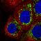 Coiled-Coil Domain Containing 191 antibody, HPA047833, Atlas Antibodies, Immunofluorescence image 