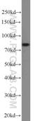 Nucleolar Protein 9 antibody, 16083-1-AP, Proteintech Group, Western Blot image 