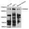 KDM4A antibody, A7953, ABclonal Technology, Western Blot image 